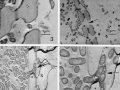 Microscopic Photography Reveals Bacteria Destroying Grape Plant Cell Wall